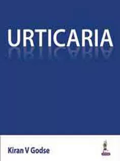 Urticaria