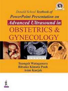 Donald School Textbook of PowerPoint Presentation on Advanced Ultrasound in Obstetrics & Gynecology