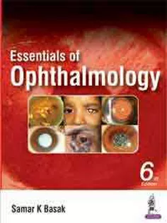 Essentials of Ophthalmology