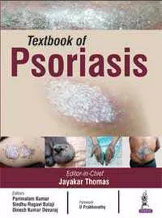Textbook of Psoriasis