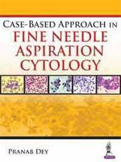 Case-Based Approach in Fine Needle Aspiration Cytology