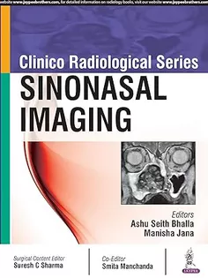 Sinonasal Imaging