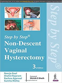 Non-Descent Vaginal Hysterectomy