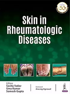 Skin in Rheumatologic Diseases