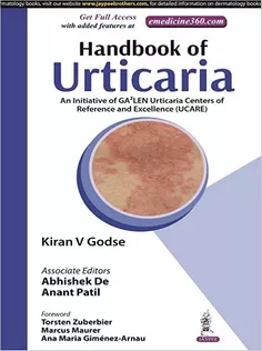 Handbook of Urticaria: An Initiative of Ga2len Urticaria Centers of Reference and Excellence