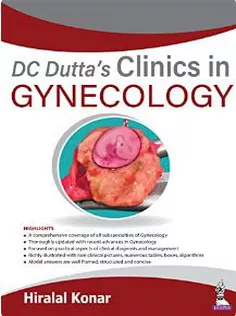 DC Dutta’s Clinics in Gynecology