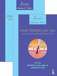 Hair Transplant 360: Follicular Unit Excision (FUE)