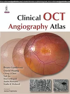 Clinical OCT Angiography Atlas