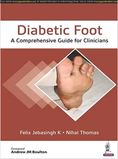 Diabetic Foot: A Comprehensive Guide for Physicians