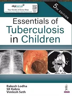 Essentials of Tuberculosis in Children