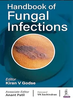 Handbook of Fungal Infections