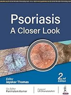 Psoriasis: A Closer Look