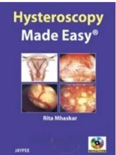 Hysteroscopy Made Easy