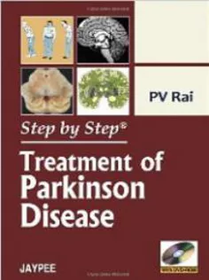 Step by Step Treatment of Parkinson Disease