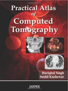 Practical Atlas Of Computed Tomography