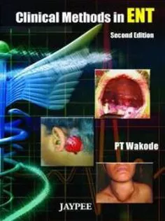 Clinical Methods in ENT