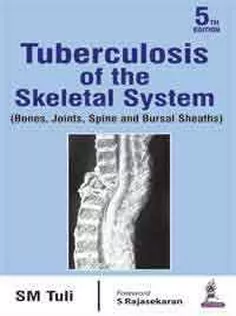 Tuberculosis of the Skeletal System