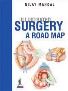 Illustrated Surgery A Road Map