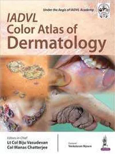 IADVL Color Atlas of Dermatology
