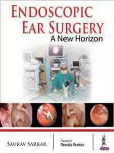 Endoscopic Ear Surgery: A New Horizon