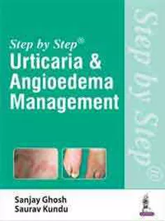 Urticaria & Angioedema Management