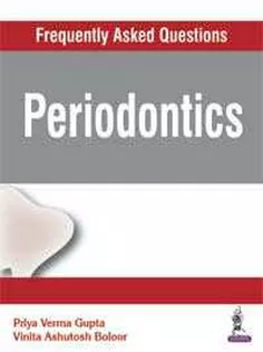 Periodontics (Frequently Asked Questions)