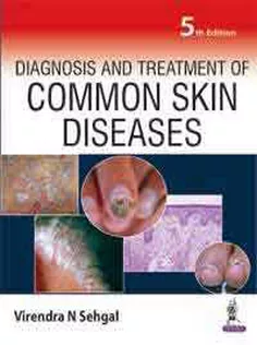 Diagnosis and Treatment of Common Skin Diseases