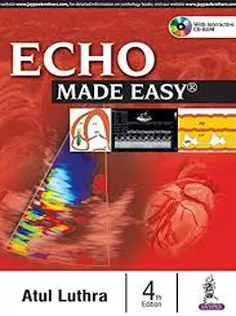 Echo Made Easy
