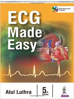 ECG Made Easy