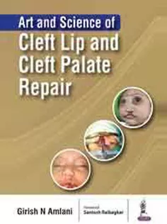 Art and Science of Cleft Lip and Cleft Palate Repair