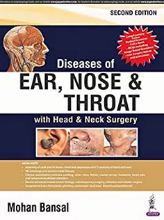 Diseases of Ear, Nose and Throat: with Head & Neck Surgery