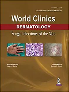 World Clinics Dermatology: Fungal Infections of the Skin