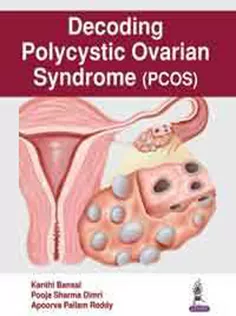 Decoding Polycystic Ovarian Syndrome-PCOS