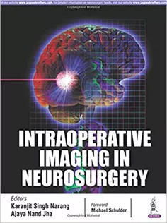 Intraoperative Imaging in Neurosurgery