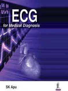 ECG for Medical Diagnosis