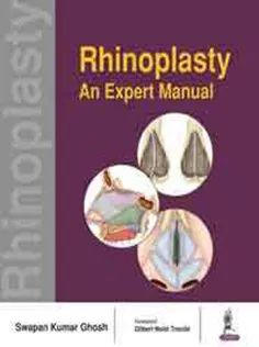 Rhinoplasty: An Expert Manual