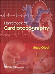 Handbook Of Cardiotocography