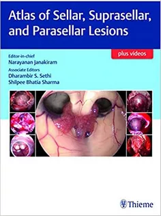 Atlas of Sellar, Suprasellar and Parasellar Lesions