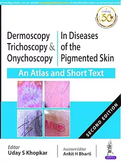 Dermoscopy Trichoscopy & Onychoscopy in Diseases of the Pigmented Skin (An Atlas and Short Text)
