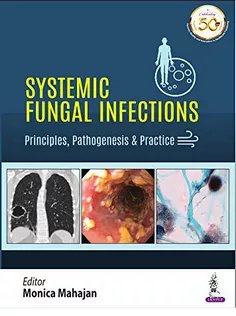 Systemic Fungal Infections