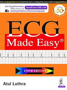 ECG Made Easy
