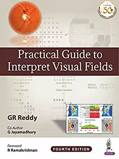 Practical Guide to Interpret Visual Fields