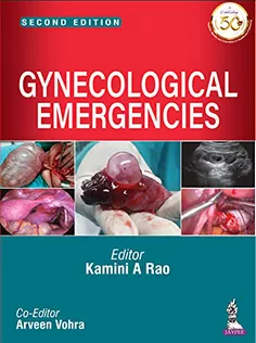 Gynecological Emergencies
