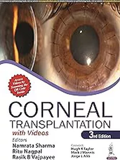 Corneal Transplantation
