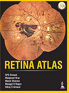 Retina Atlas