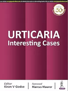 Urticaria: Interesting Cases