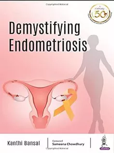 Demystifying Endometriosis