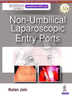 Non-Umbilical Laparoscopic Entry Ports