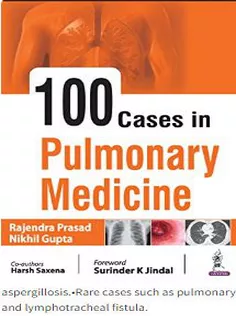 100 Cases in Pulmonary Medicine