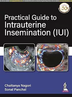 Practical Guide to Intrauterine Insemination -IUI